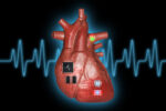 New artery chip could outsmart strokes before disaster New artery chip could outsmart strokes before disaster